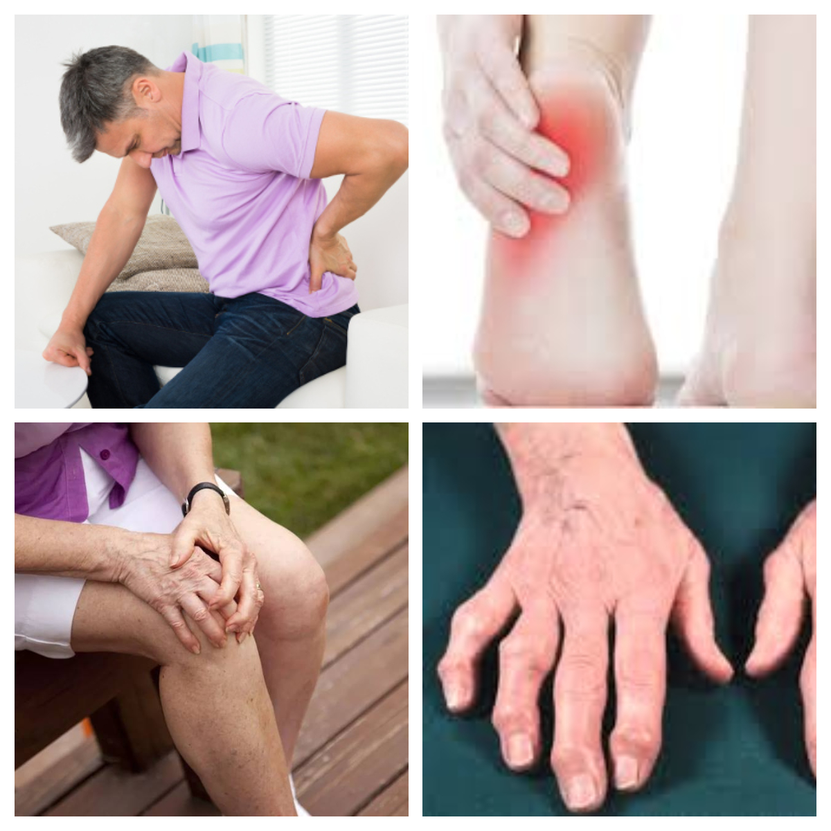 Degenerative arthritis/Osteoarthritis/ Degenerative disc disease